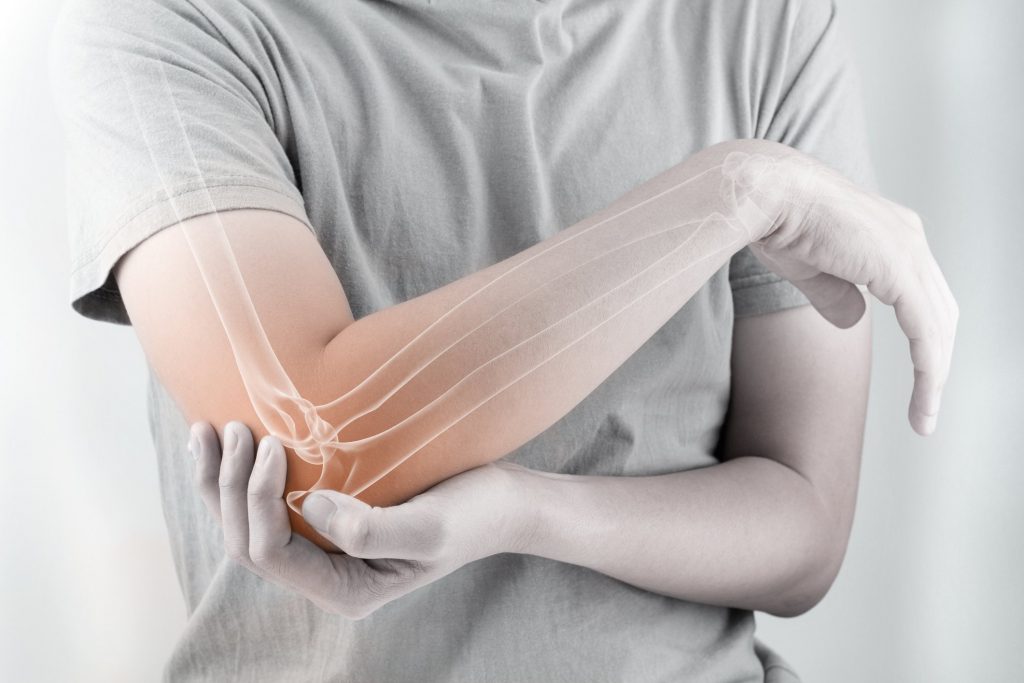 Man holding arm with painful elbow